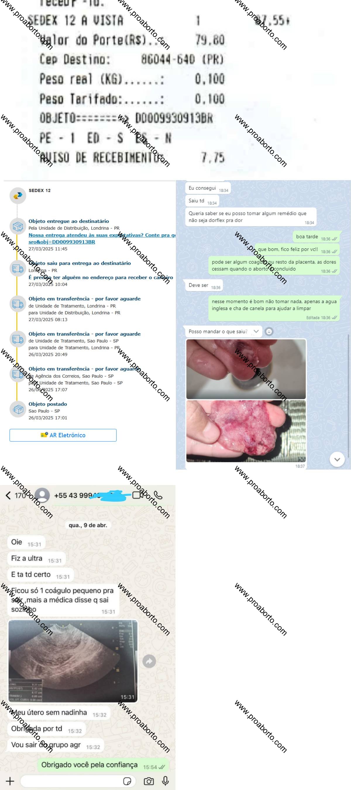 Imagem de Misoprostol valor aqui Santo Antônio da Barra Goiás