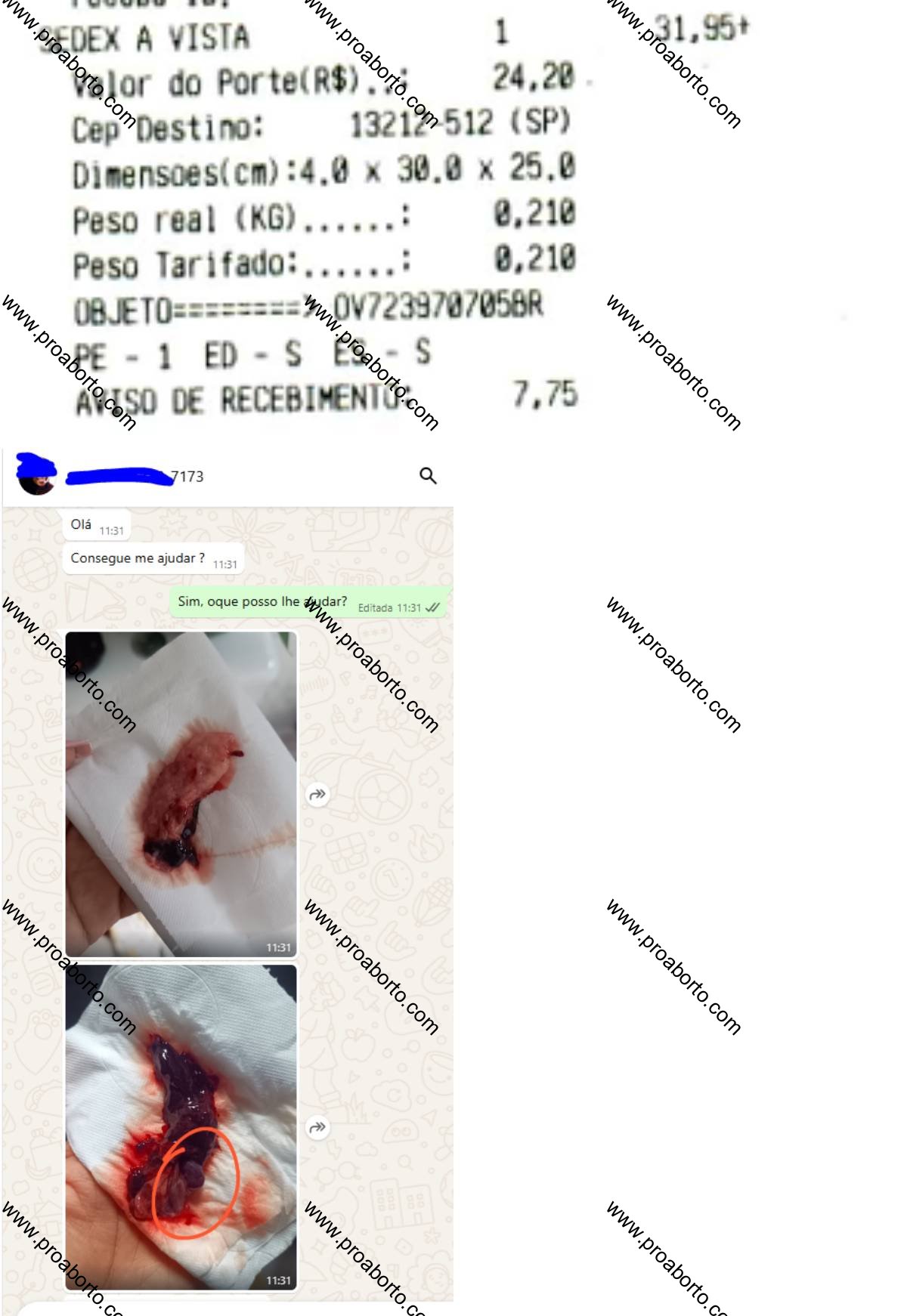 Imagem de Cytotec como usar aqui Ipiranga do Piauí Piauí
